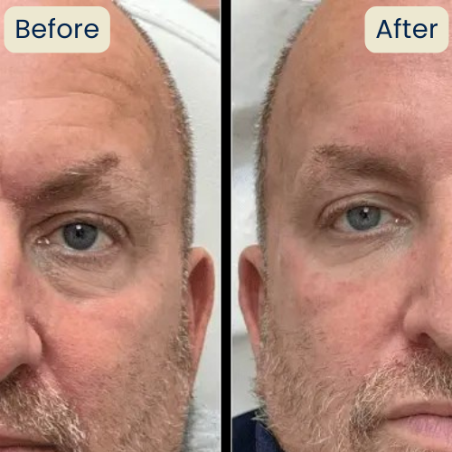 Nolvana Copper Peptide Serum