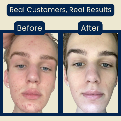 Nolvana Copper Peptide Serum