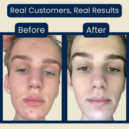 Nolvana Copper Peptide Serum