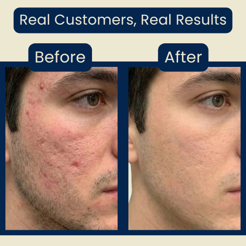 Nolvana Copper Peptide Serum