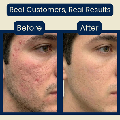 Nolvana Copper Peptide Serum