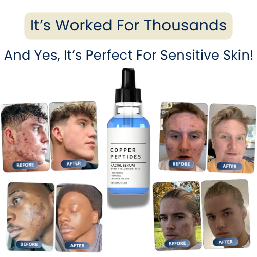 Nolvana Copper Peptide Serum