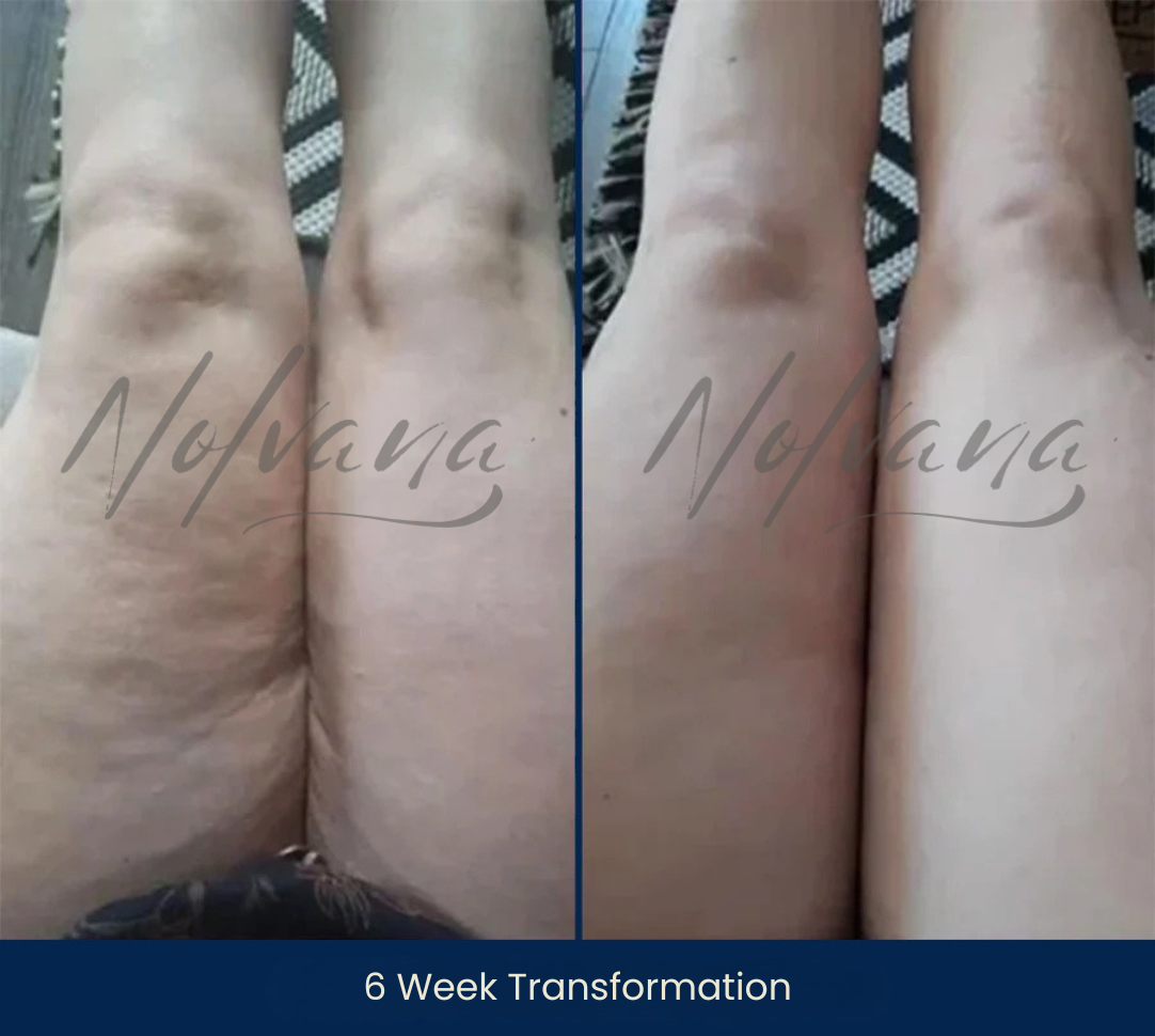 Hannah’s before-and-after photos showing a 6-week transformation