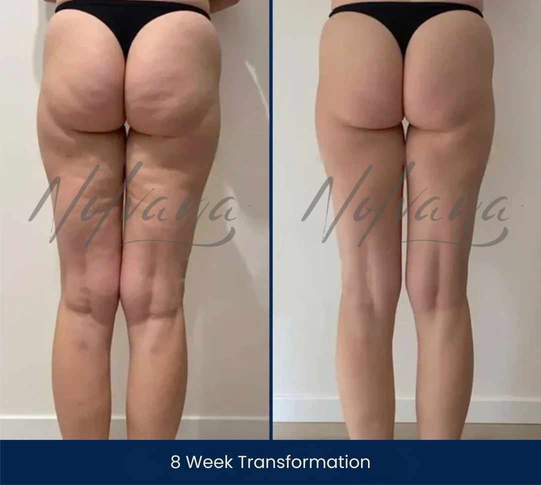 Helen’s before-and-after photos showing a 8-week transformation