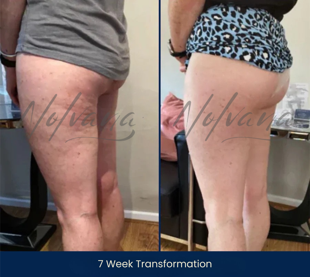 Leanne’s before-and-after photos showing a 7-week transformation
