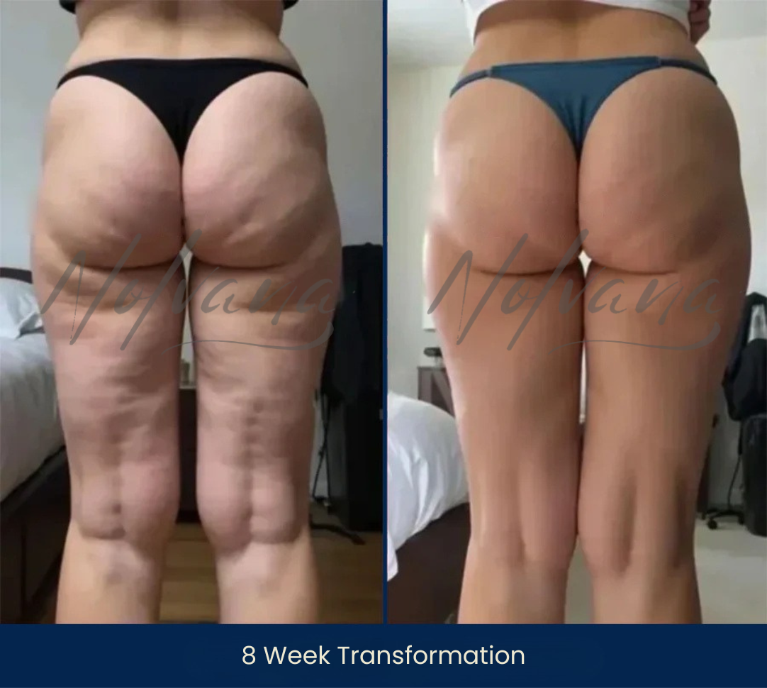 Sarah’s before-and-after photos showing a 8-week transformation